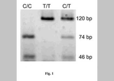 Method for diagnosing of susceptibility to post-traumatic respiratory scar-tissue formation